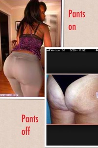 Collage